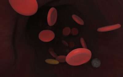 Comparing Clopidogrel Versus Prasugrel